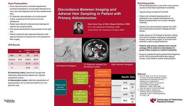 Discordance Between Imaging and Adrenal Vein Sampling in Patient with Primary Aldosteronism

