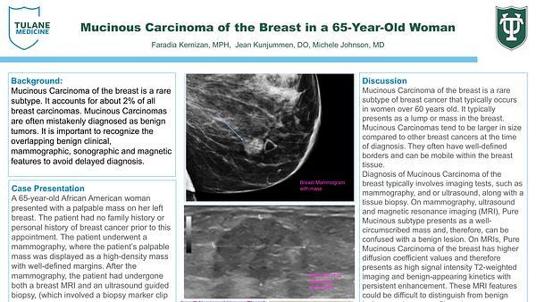 Mucinous Carcinoma of the Breast in a 65-Year-Old Woman