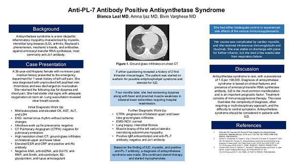 Anti-PL-7 Antibody Positive Antisynthetase Syndrome