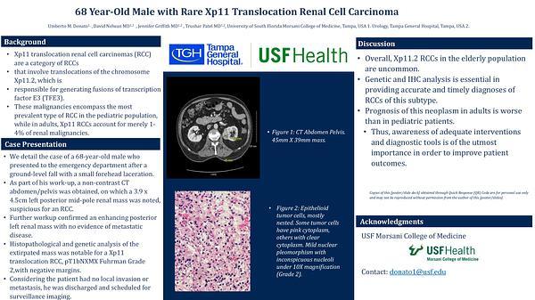 68 Year-Old Male with Rare Xp11 Translocation Renal Cell Carcinoma
