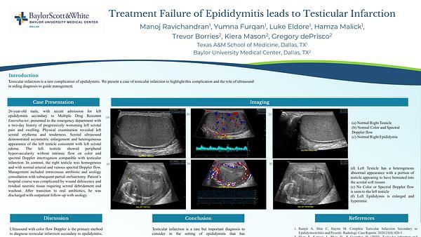 Treatment Failure of Epididymitis leads to Testicular Infarction