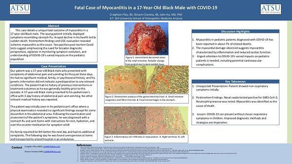 Fatal Case of Myocarditis in a 17-Year-Old Black Male with COVID-19