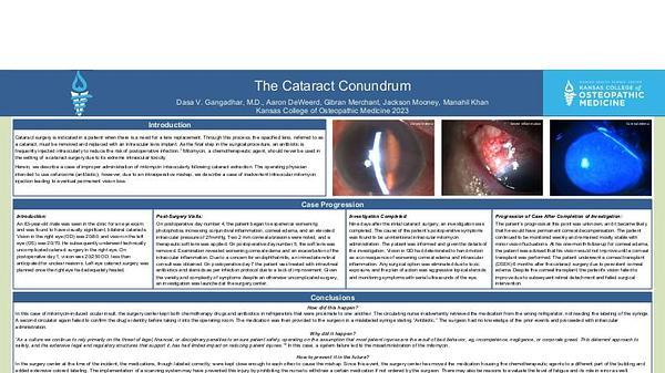 The Cataract Conundrum