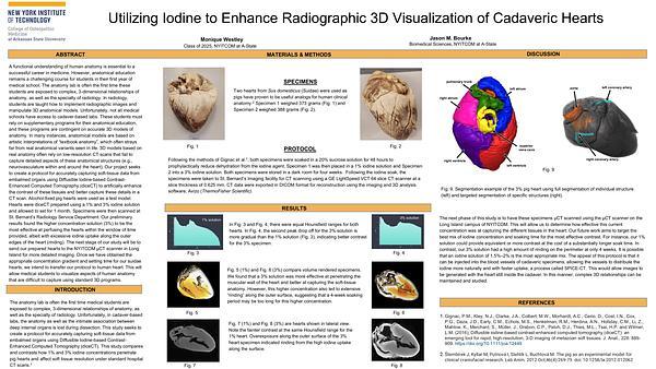 Utilizing Iodine to Enhance Radiographic 3D Visualization of Cadaveric Hearts